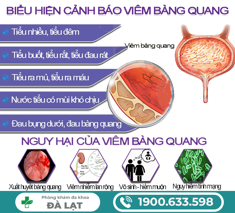 Hình ảnh minh họa